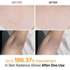 Dr. Melaxin Kojic Acid & Turmeric Body Peeling Spray – Exfoliating & Glow Care