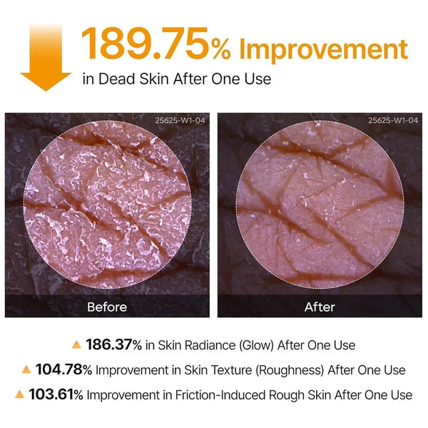 Dr. Melaxin Kojic Acid & Turmeric Body Peeling Spray – Exfoliating & Glow Care