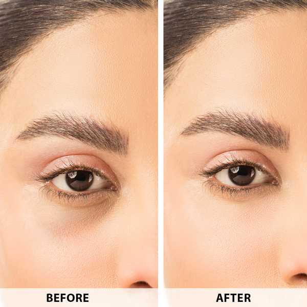 Anua retinol cream - Reduce Wrinkle, fine lines & Hyperpigmentation - Guaranteed Results