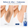 NNQ hair Removal Spray for Men & Women