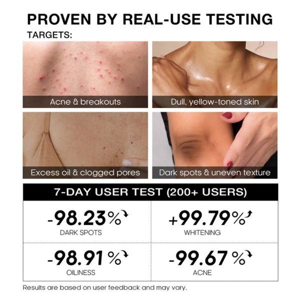 TeaShell Brightening Soap +Teashell Niacinamide Brightening Serum | 5%